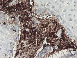 F13A1 / Factor XIIIa Antibody (clone OTI3E3, Carrier-free)