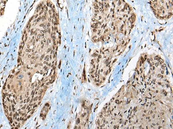 CCDC12 Antibody