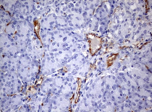 PECAM-1 / CD31 Antibody (clone UMAB31, Carrier-free)