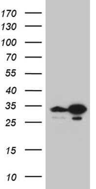 TSN / Translin Antibody (aa1-51, clone OTI4C6)