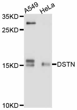 DSTN / Destrin Antibody