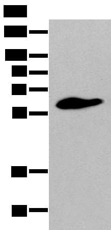 Polyclonal Rabbit anti-Human STEAP2 Antibody (WB)