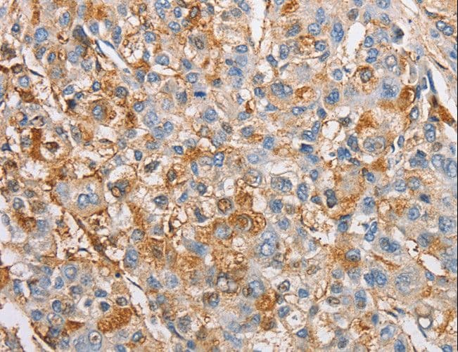 IKBKG / NEMO / IKK Gamma Antibody