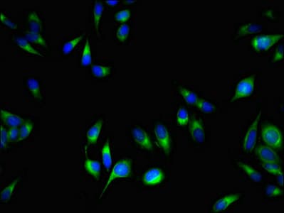 PCOTH Antibody