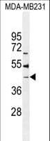 B4GALT6 Antibody (aa319-346)