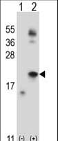 IL21 Antibody (aa104-132)