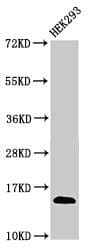 T-cell receptor beta-chain V region, clone WBDM28A Antibody