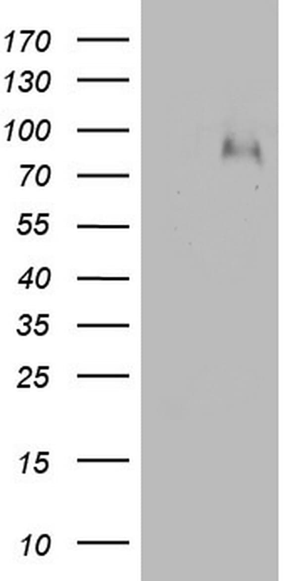 F13B / TGase Antibody (aa357-661, clone OTI1A3)