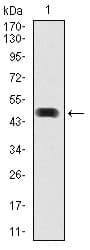 IHC-plus™ HSP90AA1 / Hsp90 Alpha A1 Antibody (aa275-484, clone 5G5)