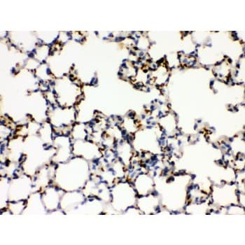 ITGA2B / CD41 Antibody (aa677-711)