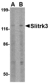 SLITRK3 Antibody