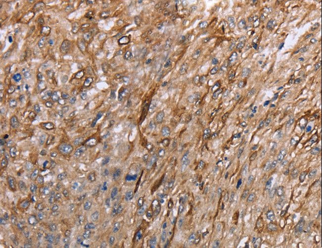 Polyclonal Rabbit anti-Human GRPR Antibody (aa322-365, IHC, WB)