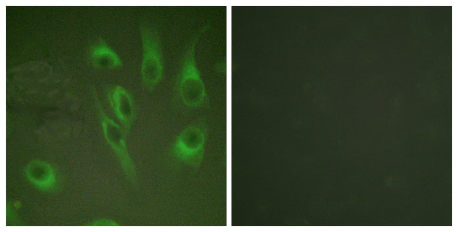 Polyclonal Rabbit anti-Human CANX / Calnexin Antibody (phospho-Ser583, IHC, IF, WB)