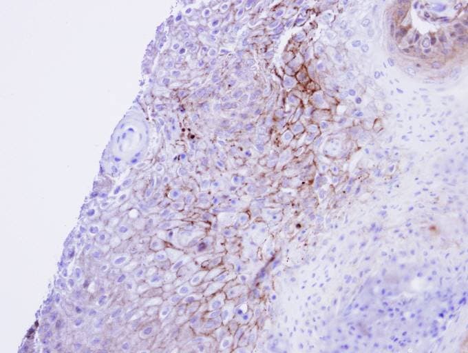 CACNA1S / Cav1.1 Antibody (aa544-885)