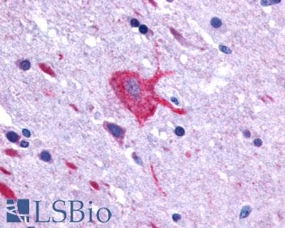 IHC-plus™ GPR48 / LGR4 Antibody (C-Terminus)