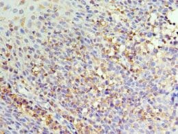 IL22RA1 / IL22R Antibody (aa16-230)