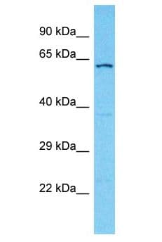 DCAF6 / NRIP Antibody (aa484-533)
