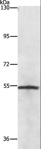 NEK2 Antibody