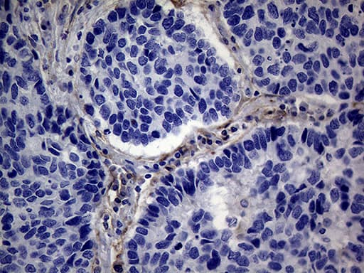 PMP22 Antibody (clone OTI5D1)