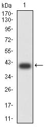 Complement C1QA Antibody (clone 1C7G3)