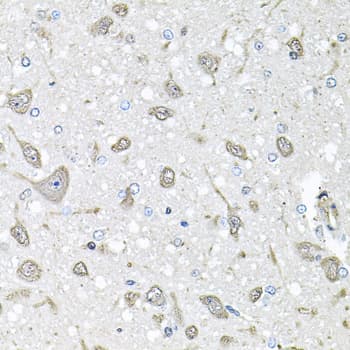 FGF1 / Acidic FGF Antibody
