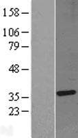SIP1 Protein (Over-Expression Lysate Myc-DDK (Flag))