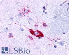 PathPlus™ Polyclonal Rabbit anti-Human TACR1 / NK1R Antibody (Extracellular Domain, IHC)