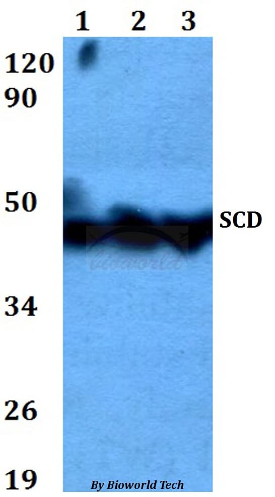 SCD1 / SCD Antibody
