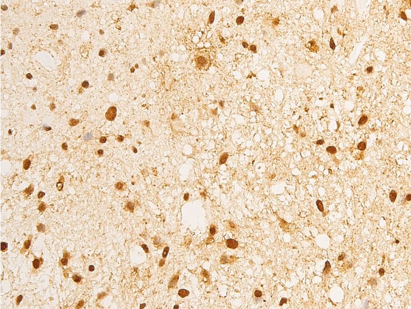 ERBB2 / HER2 Antibody (phospho-Tyr1248)