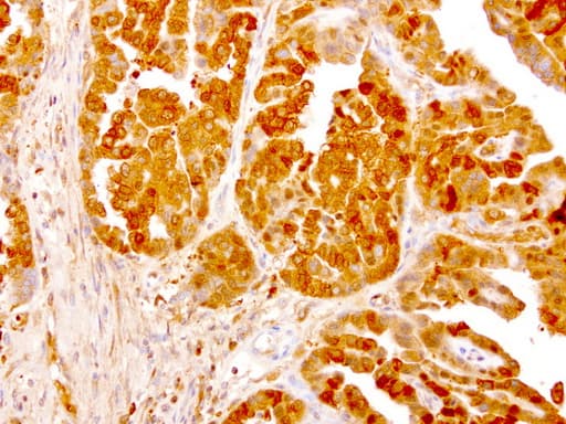 NME1 / NM23 Antibody (clone UMAB94)