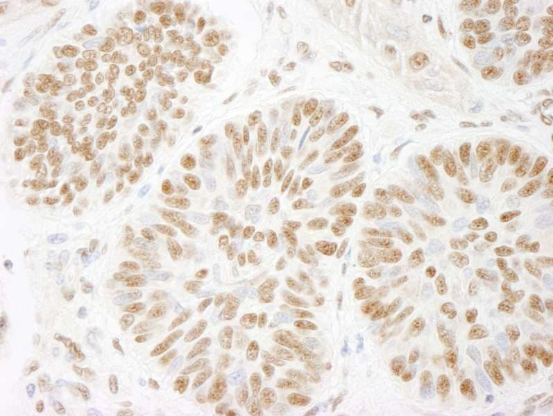 Polyclonal Rabbit anti-Human ACIN1 / Acinus Antibody (aa1291-C-term, IHC)