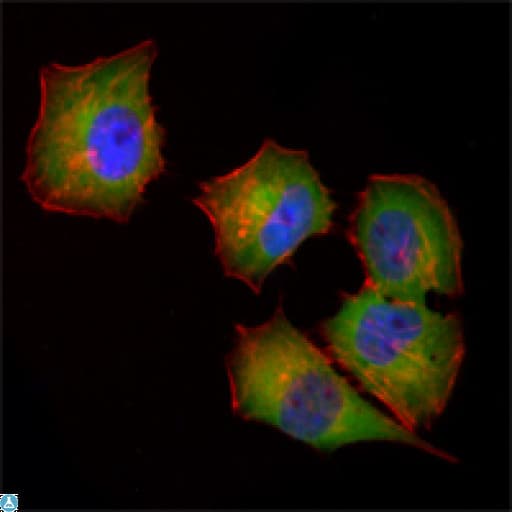 NME1 / NM23 Antibody