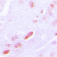 HSP90B1 / GP96 / GRP94 Antibody (C-Terminus)