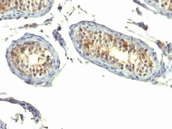 TGFA / TGF Alpha Antibody (aa34-43, clone P/T1)