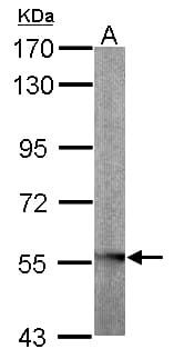 IHC-plus™ GLYCTK / Glycerate Kinase Antibody (aa144-523)