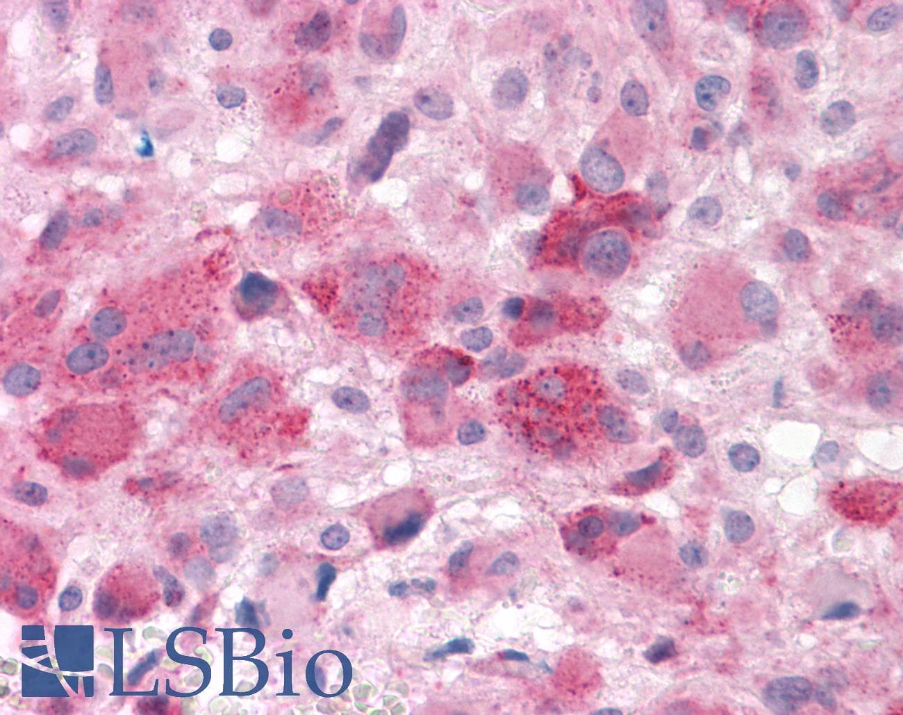 PathPlus™ HTR7 / 5HT7 Receptor Antibody (C-Terminus)