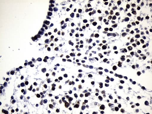 EGFR Antibody (clone UMAB234)