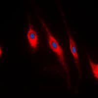 PDLIM1 Antibody (Internal)
