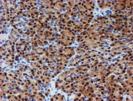 PGM3 Antibody (clone OTI1A11)