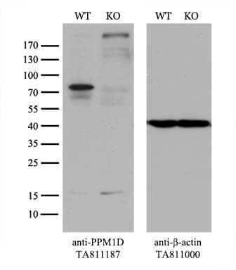 Monoclonal Mouse anti-Human PPM1D / WIP1 Antibody (clone OTI3E1, aa1-375, WB)