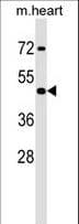 Polyclonal Rabbit anti-Mouse HOXA2 Antibody (aa190-217, WB)