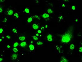 RPA2 / RFA2 / RPA34 Antibody (clone OTI7C12)
