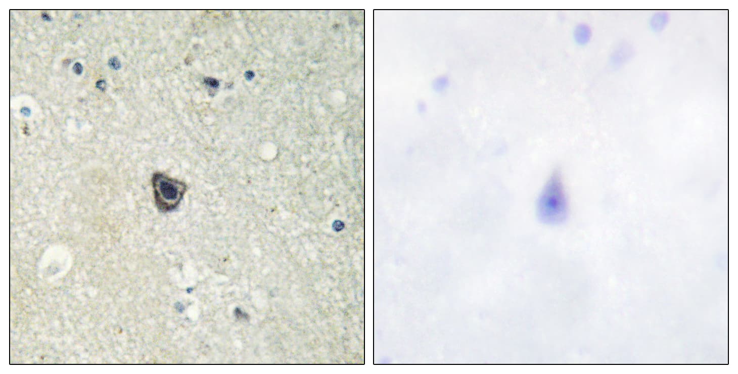 CSF1R / CD115 / FMS Antibody (aa781-830)