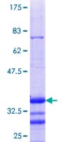 Human SPOP Protein (Recombinant GST, N-terminus)