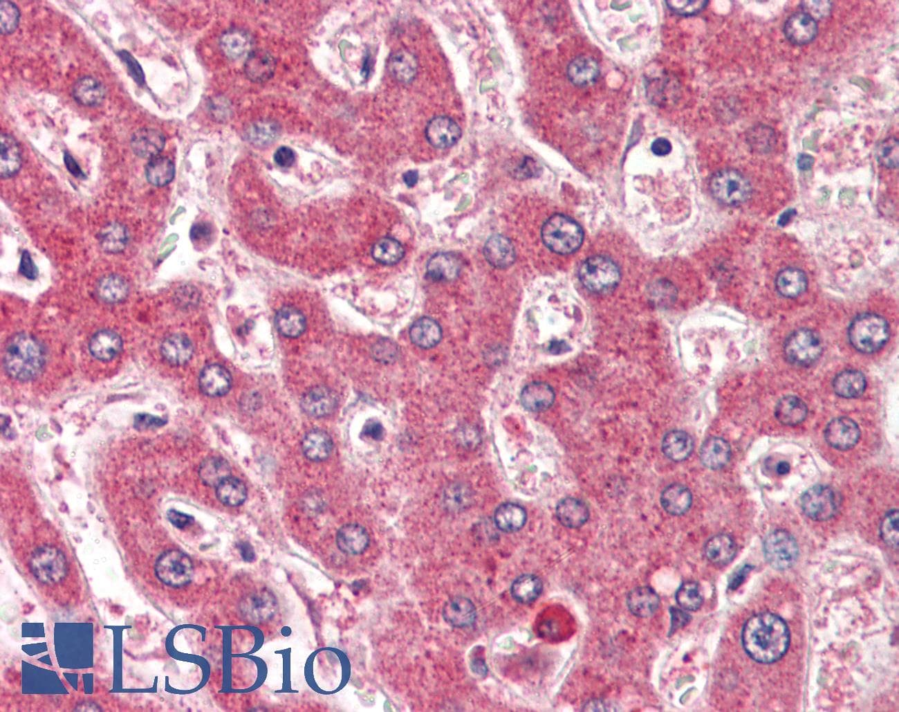 IHC-plus™ ROBO1 Antibody (aa994-1006)