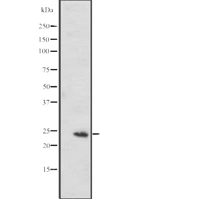 Polyclonal Rabbit anti-Human MED20 Antibody (WB)