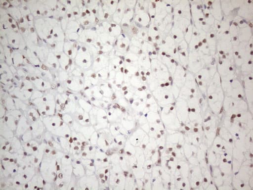 Monoclonal Mouse anti-Human PRPK / TP53RK Antibody (clone OTI5G7, IHC, WB)