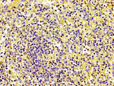 PECAM-1 / CD31 Antibody (clone 9E6E12)