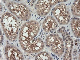 MAP2K3 / MEK3 / MKK3 Antibody (clone OTI5D3, Carrier-free)