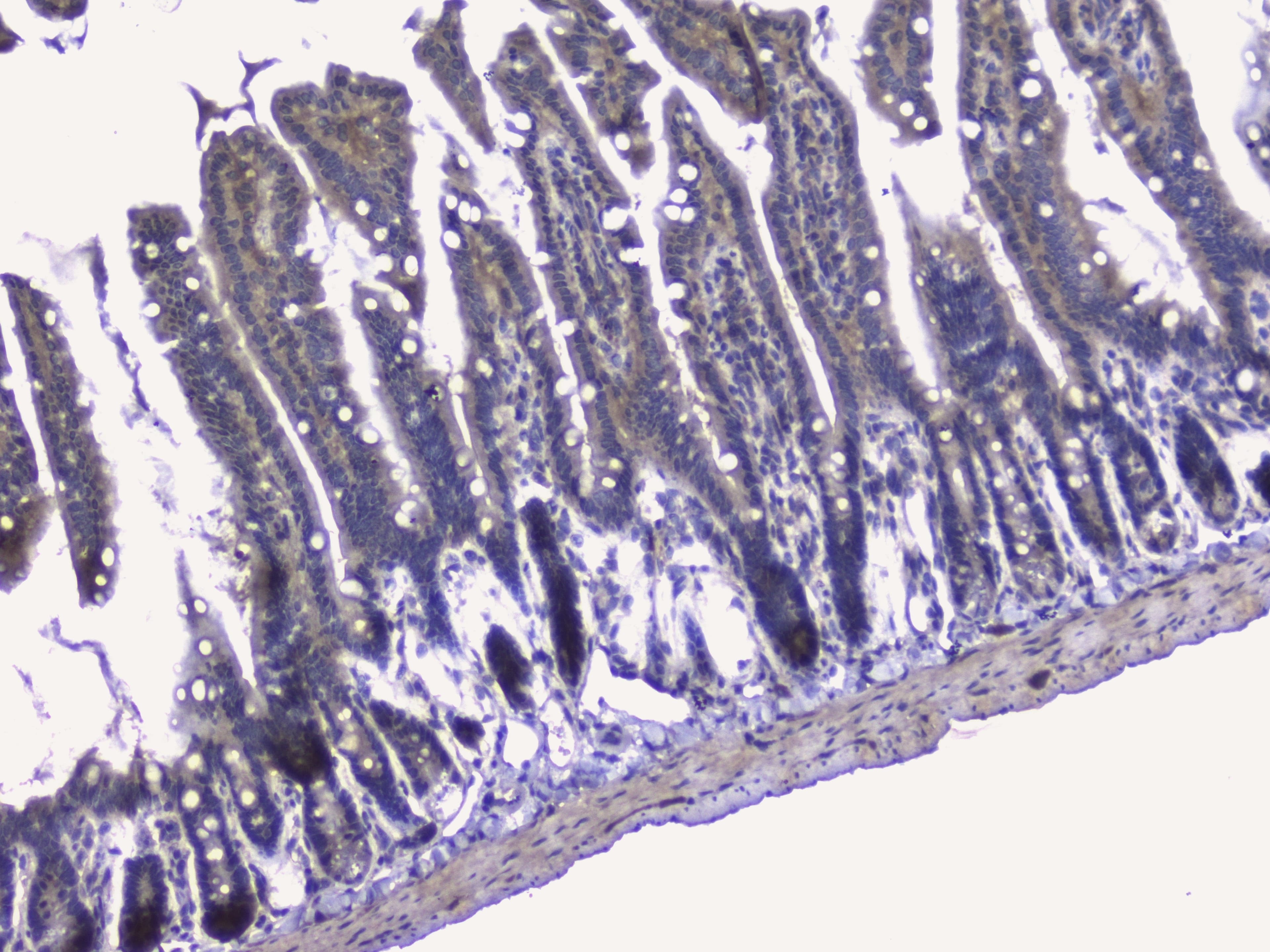 Polyclonal Rabbit anti-Human RIP1 / RALBP1 Antibody (IHC, WB)